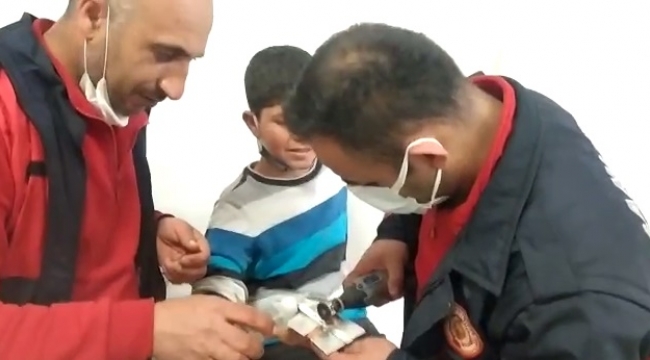 İtfaiyeden yüzük çıkarma operasyonu