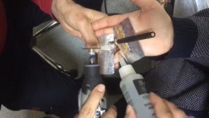 Şanlıurfa'da başarılı yüzük çıkarma operasyonu