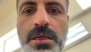 Karaköprü'ye maç sonrası saldırı 