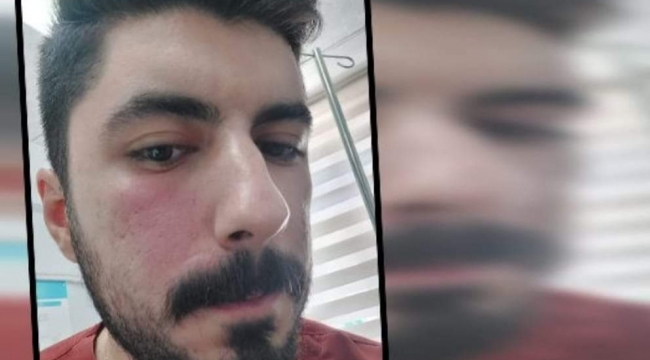 Şanlıurfa'da sağlık çalışanları darp edildi 