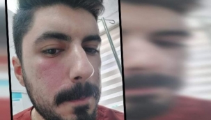 Şanlıurfa'da sağlık çalışanları darp edildi 