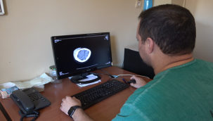 Bilinci kapalı olarak gelen kisthidatik hastası şifa ile evine gitti