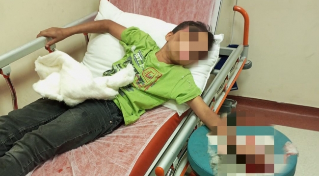 Şanlıurfa'da küçük çocuğun yardımına itfaiye ekipleri koştu
