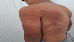 Şanlıurfa'da zincirle işkence iddiasında yeni gelişme!