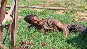 Urfa'da kuduz olan genç hastaneden kaçtı!