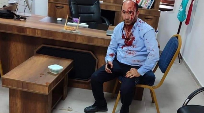 Akçakale'de okul müdürüne demir sopalı saldırı