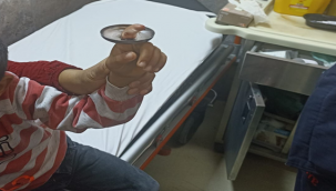 Şanlıurfa'da parmağına sac sıkışan çocuğu itfaiye ekibi kurtardı