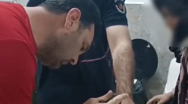 Sıkışan yüzük operasyonu ile çıkartıldı 