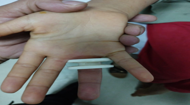 Eyyübiye'de Parmağına plastik parçası sıkışan çocuğu itfaiye kurtardı