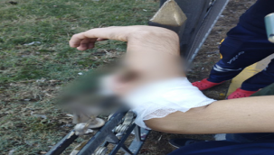 Şanlıurfa'da dikkatsizlik canından ediyordu!