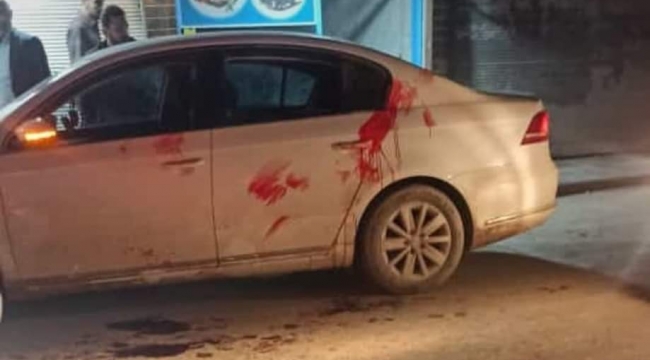 Şanlıurfa'da silahlı kavga, 1 ölü, 4 yaralı