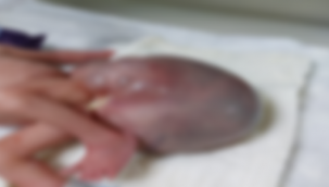 Şanlıurfa'da 3 katı büyüklüğünde kitle ile dünyaya geldi