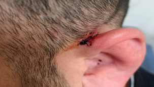 Kaçak Elektrik Kullanımı Cezasız Kalmıyor