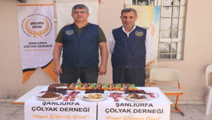 Doğan, "Türkiye' de yaklaşık 152 bin çölyaklı kardeşlerimiz var"