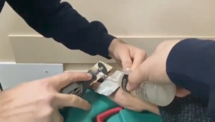 Şanlıurfa itfaiyesinden yüzük operasyonu