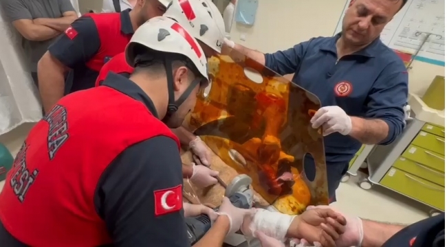Şanlıurfa'da Bir Vatandaşın Koluna İnşaat Demiri Saplandı