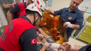 Şanlıurfa'da Bir Vatandaşın Koluna İnşaat Demiri Saplandı