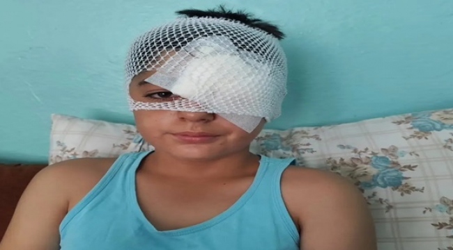 Viranşehir'de Köpekten Kaçan Çocuğa Otomobil Çarptı