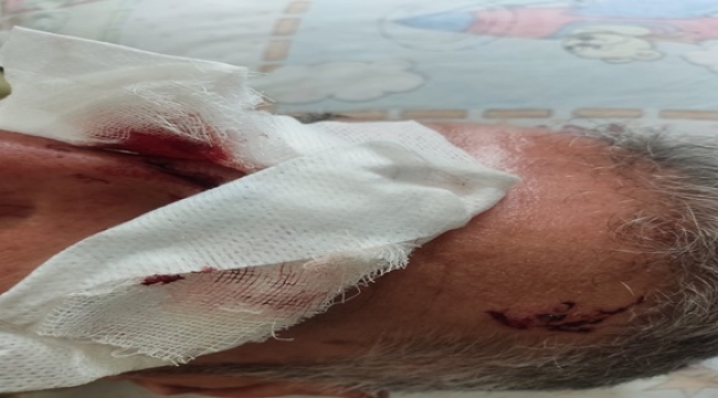 Şanlıurfa'da Başıboş Köpekler Vatandaşlara Saldırdı: İki Yaralı