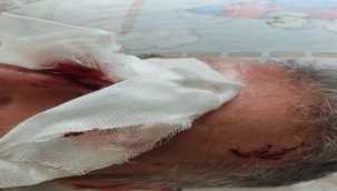 Şanlıurfa'da Başıboş Köpekler Vatandaşlara Saldırdı: İki Yaralı