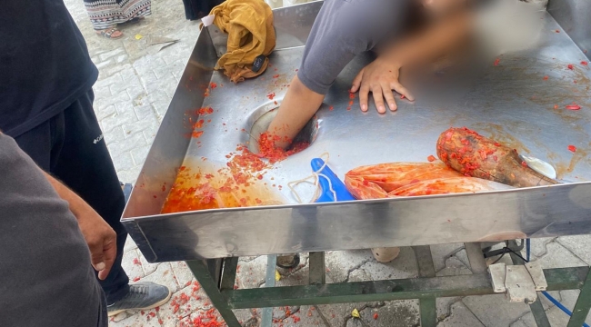 Eyyübiye'de Tehlikeli Anlar! Genç Kızın Elini İtfaiye Kurtardı