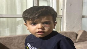 Akçakale'de Yoğun Mermi Minik Ömer'i Yaraladı