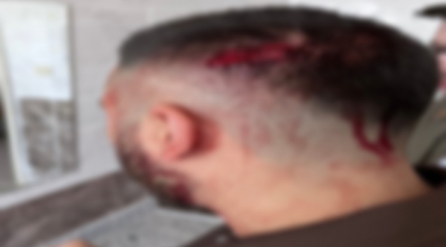 Şanlıurfa'da Öğretmene Saldırı: Şüpheli Tutuklandı