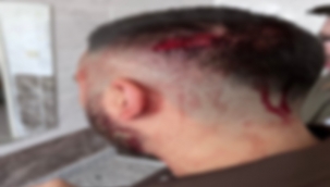 Şanlıurfa'da Öğretmene Saldırı: Şüpheli Tutuklandı