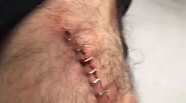 Şanlıurfa'da Öğretmene Jiletli Saldırı