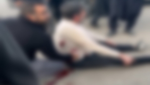 Haliliye Hal Pazarında Bıçaklı Kavga: 1 Yaralı