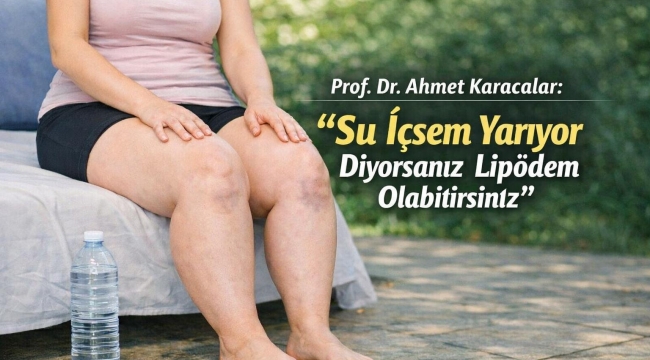 Prof. Dr. Ahmet Karacalar: "Su İçsem Yarıyor Diyorsanız Lipödem Olabilirsiniz"