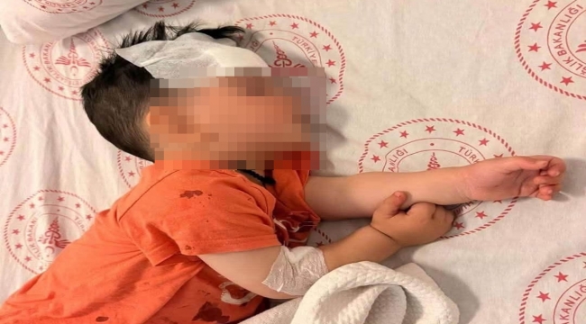 Halfeti'de Sokak Köpeği Dehşeti: Küçük Çocuğa 6 Dikiş Atıldı