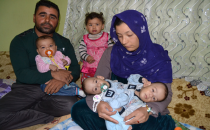 ikizler yaşam savaşını kaybettiler