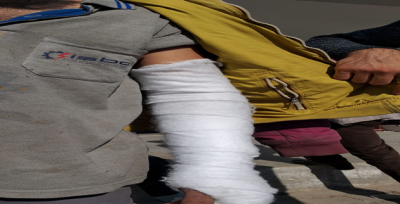 Kaçak elektrik için işçilere saldırdılar, 6 yaralı