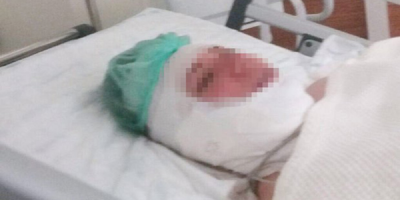 Koca şiddetinden ölü taklidi ile kurtulmuştu! 