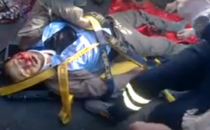 Mikserin Altında Kalan Vatandaş'ın Kalbi Yeniden Çalıştırıldı