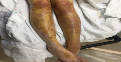  O Zanlı Gözaltına Alındı