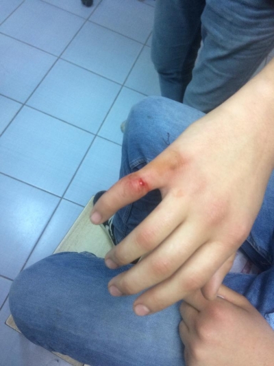 Parmağa Sıkışan Yüzüğü İtfaiye Çıkardı