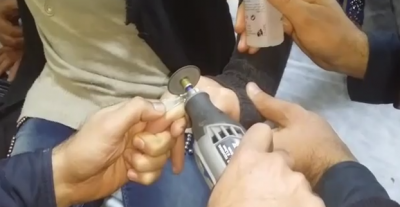 Parmağında Yüzük Sıkışan Genç Kızın İmdadına İtfaiye Yetişti