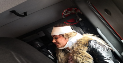 Şanlıurfa otobanında kaza, 2  yaralı