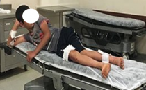 Şanlıurfa'da köpek çocuğu ısırdı