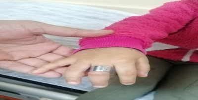 Şanlıurfa'da parmağında sıkışan yüzüğü itfaiye çıkardı