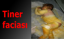 Suriyeli kız Şanlıurfa'da can verdi