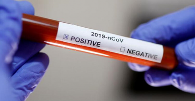 Türkiye'de 8 Haziran günü koronavirüs nedeniyle 19 kişi hayatını kaybetti