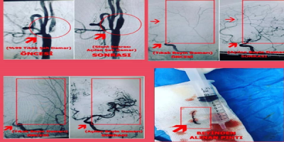 Urfa'da Başarılı Operasyon...