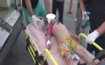 Urfa'da elektrik akımına kapılan 2 çocuk yaralandı