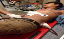 Urfa'da Genç Çocuğa 1 Metrelik Şiş  Saplandı