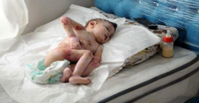 Vali  Erin, Destek için talimat verdi