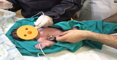 Yeni Açılan Serviste İlk Bebekler Dünyaya Geldi