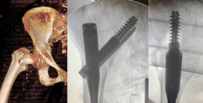 Yüzündeki izlerle o hastayı ameliyat etti!